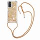 thumbnail image 4 of Funda FOXDOCK para Xiaomi Redmi Note 11/11s 4G con Cuerda Ajustable, Brillo Líquido, Protección Antigolpes y Lente – Ideal para Regalo, 4 of 6