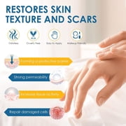 Scar Cream, Scar Mark Removal for C-Section, Stretch Marks, Acne, Surgery, Effective for Both Old and New Scars