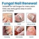 thumbnail image 3 of Nail Care Nail Repair Spray Repair and Clean Nails, Hands, Feet, Soft Nails, Thicken Nails, Polish Nails 100ml, 3 of 5