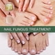 thumbnail image 2 of 50ml Nail Fungus Treatment Solution Extracts Remove Onychomycosis No Yellowing Restore Shine Nail Repair Care, 2 of 5