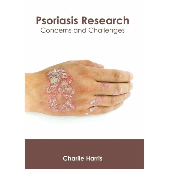 Psoriasis Research: Concerns and Challenges, (Hardcover)