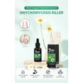 thumbnail image 6 of Nail Nutrition Oil 2 - Toenail & Fingernail Drops Nail Care for Thick Damaged & Discolored Nails 2 Pack（30Ml）, Nail Art, Glass Glass Nutrient Solution, Easter, St. Patrick'S Day, V Makeup Organizers, 6 of 7