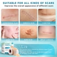 thumbnail image 4 of Silicone Scar Sheets, Silicone Scar Tape(1.6”x 60” Roll-1.5M), Silicone Scar Strips, Professional Scar Removal Sheets for Surgical Scars, Keloid, C-Section, Burn et, 4 of 8