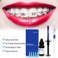 thumbnail image 4 of Kit de adhesivos para ortodoncia dental Brackets de cerámica y metal fotopolimerizables Accesorios invisibles Adhesivos Material para dentistas Herramientas, 4 of 5