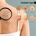 thumbnail image 5 of 1PCS Topo y verruga piel cara axila carne cuello eliminación reparación cuidado de limpieza 10ml, 5 of 5