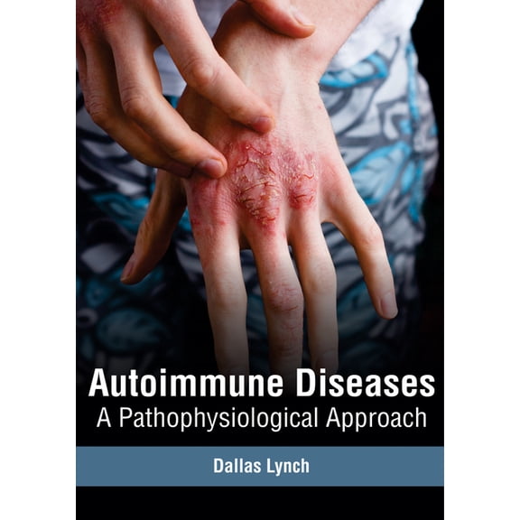Autoimmune Diseases: A Pathophysiological Approach, (Hardcover)