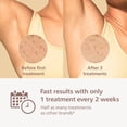 thumbnail image 4 of Depiladora Philips Lumea 8000 IPL BRI932/03, 4 of 9