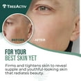 thumbnail image 2 of TreeActiv Retinol Cream, Deep Wrinkle Remover Cream, Retinol and Hyaluronic Acid, 2 fl oz, 60-Day Supply, 2 of 11