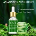 thumbnail image 2 of Clearance!Maojin Aceite de aloe Extracto antiarrugas Marcas de eliminación de acné, 2 of 9