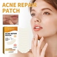 thumbnail image 4 of 5-28pcs Acne Patch Repair Blemish Pimple Remover Tool for Face Chin Forehead Breathable, 4 of 5