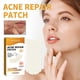 thumbnail image 4 of 5-28pcs Acne Patch Repair Blemish Pimple Remover Tool for Face Chin Forehead Breathable, 4 of 5