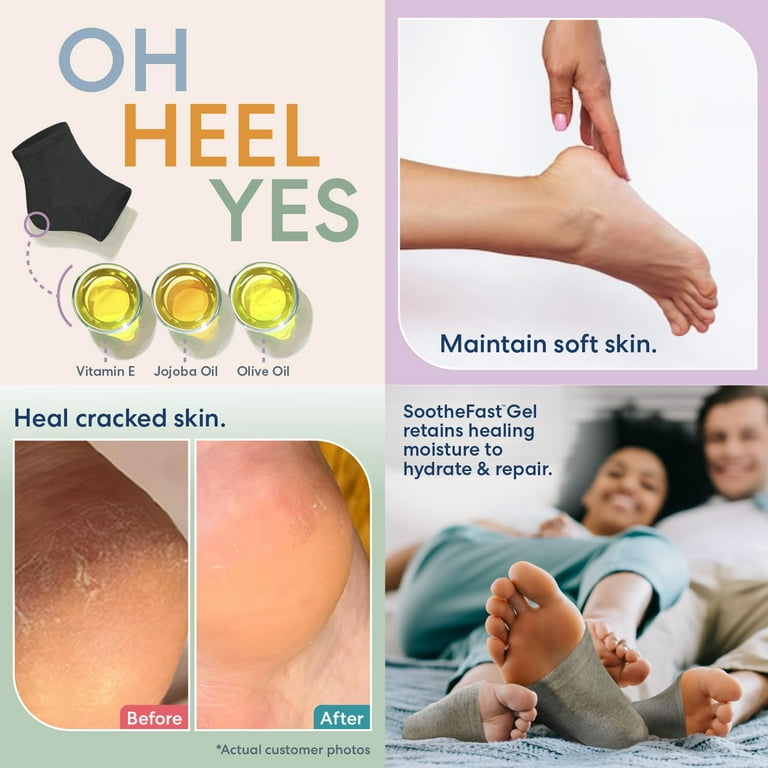 Dry Heels Ways To Heal Cracked Heels Best Way To Heal Dry Cracked
