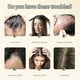 thumbnail image 3 of Ginger Plant Extract Anti-hair Loss Hair Shampoo, 2024 New Ginger Plant Extract Anti-hair Loss Hair Shampoo, Ginger Shampoo For Hair Growth, 3 of 5