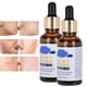 thumbnail image 1 of Sero de Extracció de Espinilla, Tratamiento de Acné natural purifica los poros extracto de planta para la vida daliy, 1 of 7