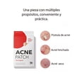 thumbnail image 2 of 2 Paquetes con 36 parches para acné, 2 of 5