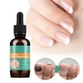 thumbnail image 2 of Sailing Líquido para hongos en las uñas Solución eficaz para las uñas de manos y pies 30 ml Sailing, 2 of 9