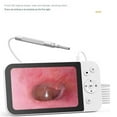 thumbnail image 2 of Digital Otoscope, Earwax Removal Tool,Visual Ear Pick,5 Inch Otoscope with Screen Visible Ear Spoon, 2 of 5