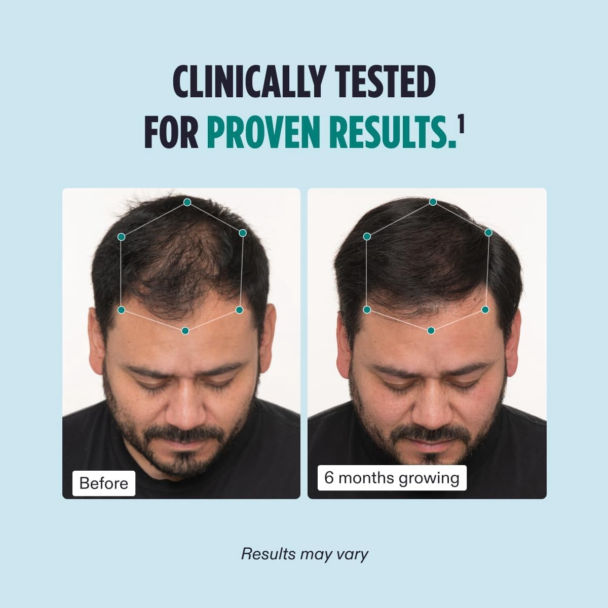 NutrafoI Men Hair Growth for Thicker | Holiday Gift-Ready, Makeup Organizers