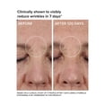 thumbnail image 2 of Sérum facial DRMTLGY sin agujas con factor de crecimiento 30 ml, 2 of 9