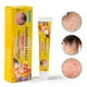 thumbnail image 1 of Crema para la psoriasis Mano Tiña Pie Olor Versicolor Inhibit Dermatitis Crema fúngica, 1 of 6