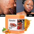 thumbnail image 1 of 100g Turmeric Soap Slimming Natural Cleansing Soap For All Skin Types, 1 of 4