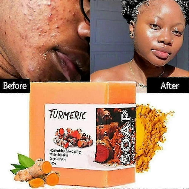 100g Turmeric Soap Slimming Natural Cleansing Soap For All Skin Types