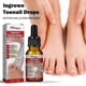 thumbnail image 1 of 10/30ml Nail Helper Ingrown Toenail Treatment Oil, Ingrown Toenail Drops, Ingrown Toenail Correction Treatment Oil For Pain Reliever And So, 1 of 2