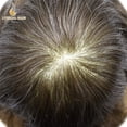 thumbnail image 4 of Lyricalhair Toupee for Men Full Lace Hairpieces Human Hair Replacement System 8"X10" Transparent Lace Mens Toupee Human Hair Units for Man Bleached Knots Male Hair Prosthesis, 4 of 7
