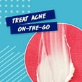 thumbnail image 5 of Clearasil Benzoyl Peroxide Rapid Rescue Spot Treatment Acne Cream, 1 fl oz, 5 of 12