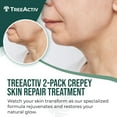 thumbnail image 3 of TreeActiv Crepey Skin Repair Cream, Unscented Firming Lotion with Hyaluronic Acid, 8 oz (2-Pack), 3 of 9