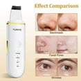 thumbnail image 6 of Skin Scrubber Face Spatula Pore Cleaner Blackhead Remover Tools for Facial Deep Cleansing 4 Modes, 6 of 12