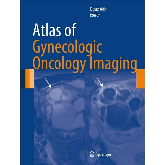 Atlas of Oncology Imaging Atlas of Gynecologic Oncology Imaging, (Hardcover)