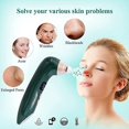thumbnail image 2 of appareil D'exportation Faciale Lectrique (vert), Chauffage D'appoint Visuel Usb Avec Camra, Recargable En 5 Vitesses Et 6 Ttes D'aspiration, 2 of 5