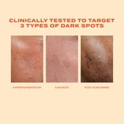 Murad Rapid Dark Spot Correcting Serum, Even Skin Tone, 1 fl oz