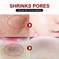thumbnail image 2 of Crema retráctil de poros con ácido salicílico, eliminación rápida de poros grandes, eliminación de puntos negros, estiramiento de la cara, piel suave, producto coreano para el cuidado, 2 of 5