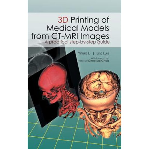 3D Printing of Medical Models from CT-MRI Images: A Practical step-by-step guide (Hardcover) by Li Yihua, Eric Luis