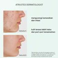 thumbnail image 4 of Ganfancp Artemisa Barro Stick Limpieza Profunda Suave a Puntos Negros Reparación Cuidado Facial Máscara Tipo Daub Suaviza Reduce Enrojecimiento Ofertas Del Día Sólo En Línea 1* Barro Facial En Barra, 4 of 7