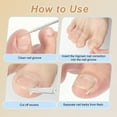 thumbnail image 3 of Unique Bargains Ingrown Toenail Correction Kit Toe Nail Corrector Tools with Leather Case for Easy Storage & Travel for Curved & Ingrown Nails with Nail Files Clipper Lifter, 3 of 7
