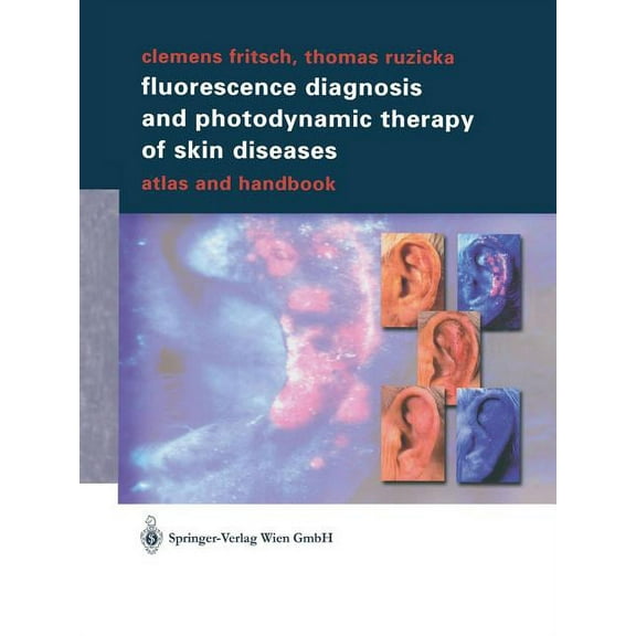 Fluorescence Diagnosis and Photodynamic Therapy of Skin Diseases: Atlas and Handbook, (Paperback)