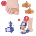 thumbnail image 1 of CHAO Enderezador de dedos, separador de dedos gordos, corrector de hallux valgus, férula, alivio del dolor de pies, protección, corrección, herramientas para el cuidado de los pies, 2 pares, 5, 1 of 5