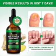 thumbnail image 2 of 1/2/3PCS Nail Fungus Treatment, Ginger Nail Fungus Treatment, Toenail Cuticle Care Oil Care, Fungal Nail Treatment, 7 Days Nail Fungus Treatment, 2 of 5