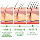 thumbnail image 3 of Rosemary Hair Care Essential Oil for Gentle Care of Scalp, Smooth and Glossy, Natural Fluffy Hair Care Essential Oil, 3 of 5