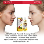 Aliver Rose Vitamin E Oil for Face Body, Rich in Vitamins and Antioxidant, Moisturizer for Dryness, Fine Lines, Scar Skin (Guasha Tool Included)