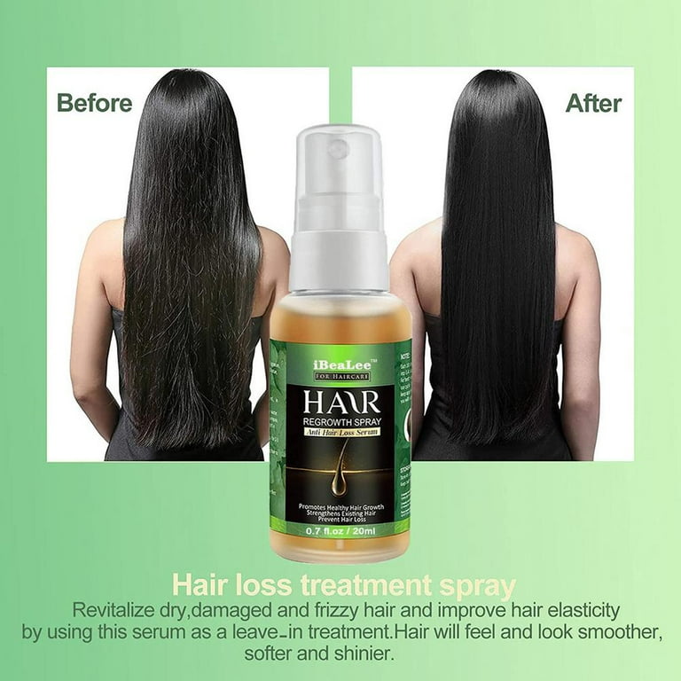 Eelhoe 30ml 1PC 7X Rapid Growth Hair Treatment Anti Hair Loss Fast Hair Growth Serum Ginger | Ginger Hair Growth Products Essence Fast Grow Oil Serum Anti Hair Loss Treatment Damaged Hair Eelhoe 30ml 1PC 7X Rapid Growth Hair Treatment Anti Hair Loss Fast Hair Growth Serum Ginger | Ginger Hair Growth Products Essence Fast Grow Oil Serum Anti Hair Loss Treatment Damaged Hair