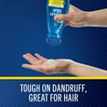 thumbnail image 4 of Selsun Blue Itchy Dry Scalp Antidandruff Shampoo, 11 fl. oz., 4 of 13