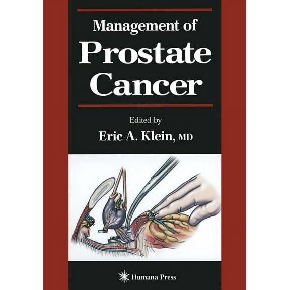 Current Clinical Urology Management of Prostate Cancer, (Paperback)