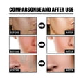 thumbnail image 3 of 1-3X Nicotinic Acid Face Anti-Aging Brighten Essences Keratins Removing Moisturizing Liquid For Facial Use, 3 of 5