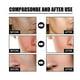 thumbnail image 3 of 1-3X Nicotinic Acid Face Anti-Aging Brighten Essences Keratins Removing Moisturizing Liquid For Facial Use, 3 of 5