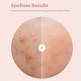 BONINGGG Hydrocolloid Pimple Patch For Covering Zits And Blemishes boninggg-hydrocolloid-pimple-patch-for-covering-zits-and-blemishes