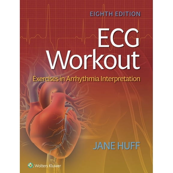 ECG Workout: Exercises in Arrhythmia Interpretation, (Paperback)
